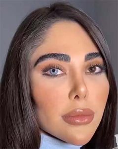 لنز آبی روی چشم قهوه ای