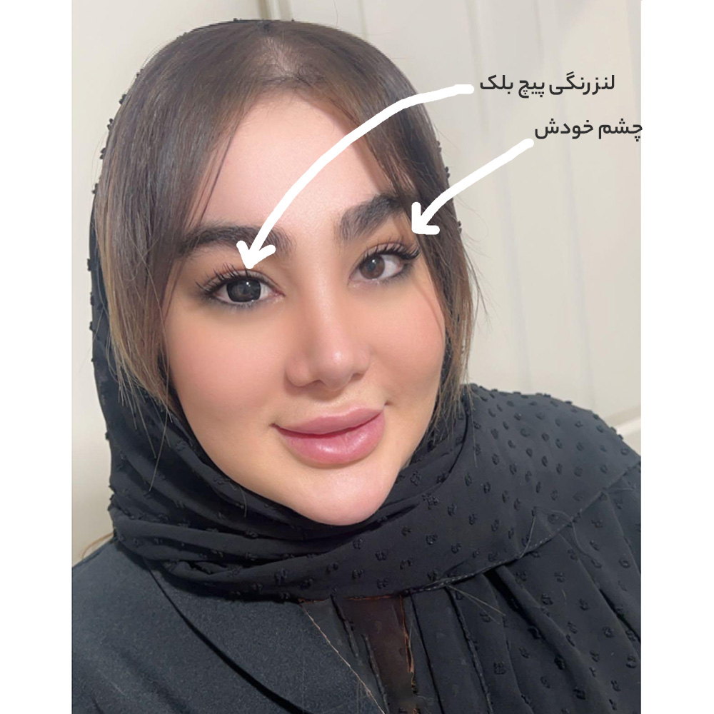 لنز مشکی عروسکی پیچ بلک آماندا